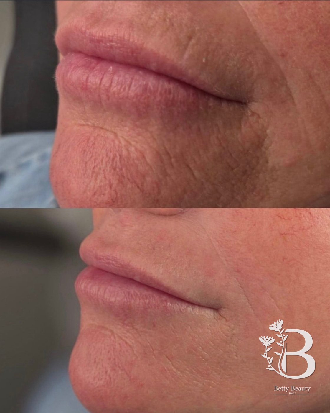 Lip blush, before and after